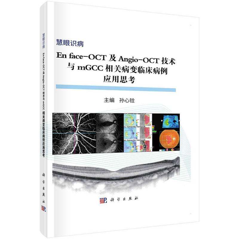 En face-OCT及Angio-OCT技术与mGCC相关病变临床病例应用思考 孙心铨 眼病影像诊断病例 医药卫生书籍科学出版社
