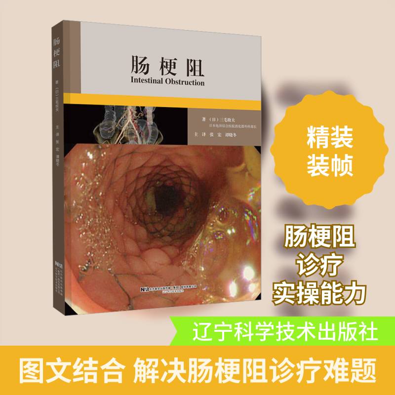 肠梗阻 三毛牧夫   医药卫生书籍辽宁科学技术出版社