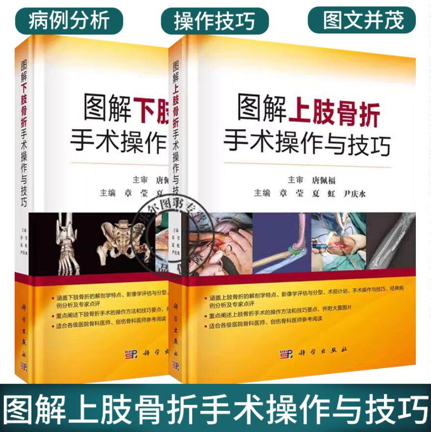 2册】图解上肢骨折手术操作与技巧+图解下肢骨折手术操作与技巧 股骨头骨折与脱位股骨颈股骨转子间股骨干股骨远端下肢骨折手术
