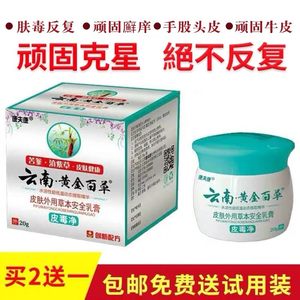 牛皮藓银屑专用特效膏