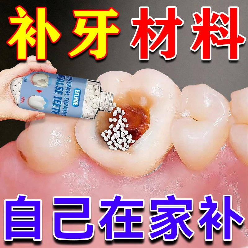 补牙神器自己填充材料永久医用进口树脂在临时家洞假牙缝粘合剂yh