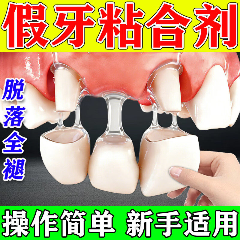 假牙粘合剂粘牙齿专用胶医用食品级树脂烤瓷牙冠自己永久粘接修复
