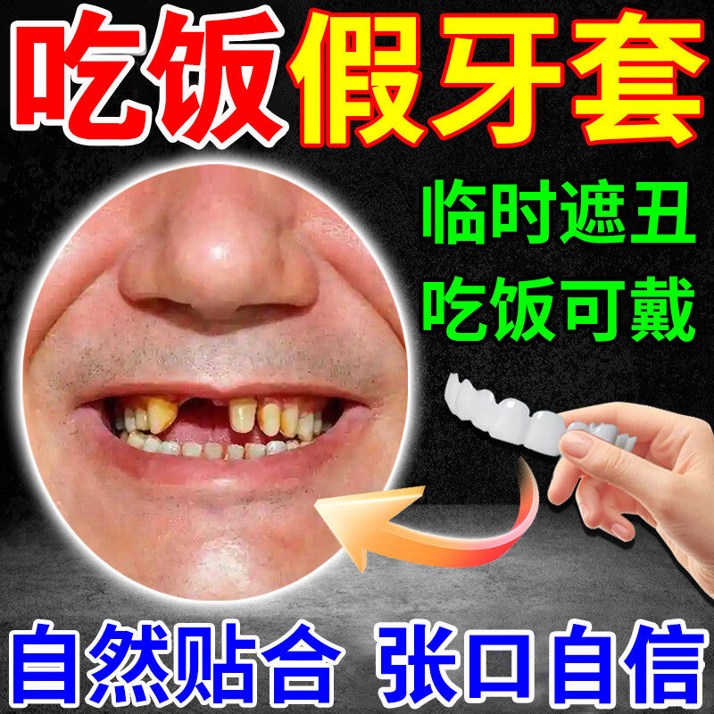 牙套通用吃饭神器成人假牙套仿真牙齿万能老年人磨牙吃饭神器遮丑