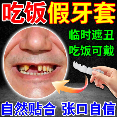 牙套通用吃饭神器成人假牙套仿真牙齿万能老年人磨牙吃饭神器遮丑