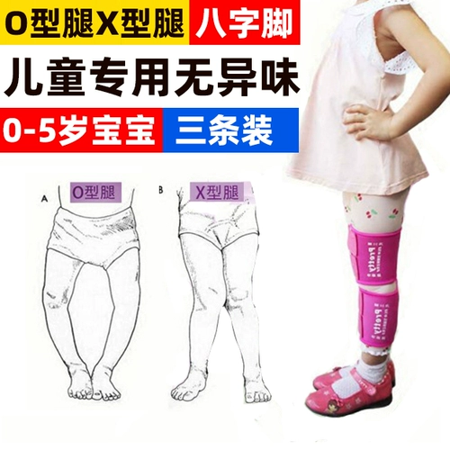 Установка коррекции детской ноги.