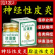 治疗神经性皮炎外用膏药顽固无激素湿去祛止痒膏疹脂溢性根中成除