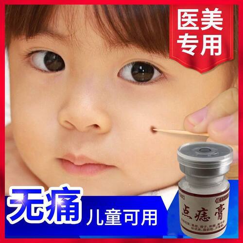 点痣笔去斑正品脸部点痦子取痣去黑痣专用点痣药水神器仪黑点去除