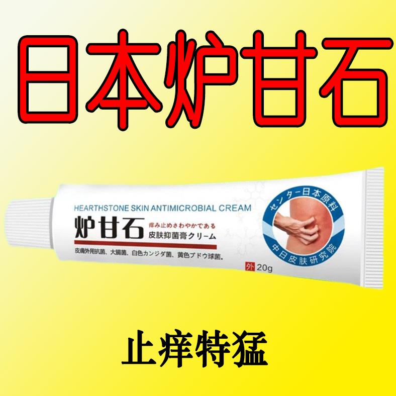 【日本炉甘石】特效皮肤瘙痒外用全身皮肤手脚干痒真菌止痒膏杀菌