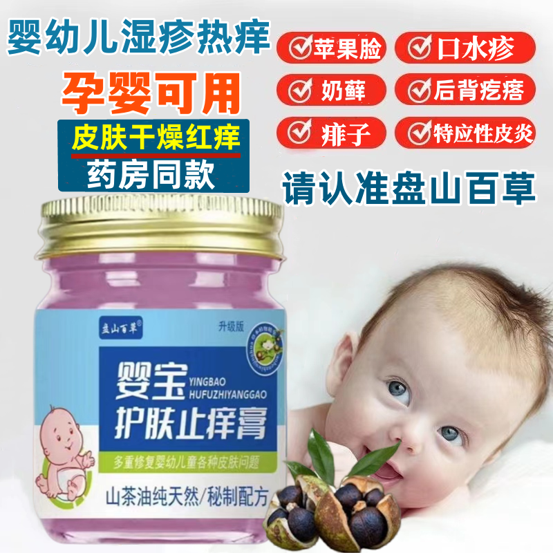 宝宝湿疹膏婴宝护肤止痒膏寻麻疹口水疹皮炎过敏蚊虫叮咬奶癣痤疮