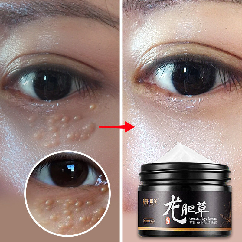 花田美芙龙胆草精华霜祛脂肪粒神器淡化黑眼圈细纹眼袋眼霜正品