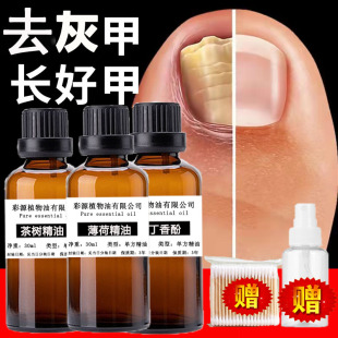去灰指甲精油茶树薄荷精油丁香酚脚趾脱甲抑箘坏甲儿童大人可用
