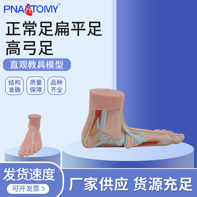 PNT-1727B正常足扁平足弓形足模型/足弓模型 解剖模型 脚模型