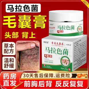 香港大药房马拉色菌毛囊炎膏头部前胸背上长痘痘祥医堂旗舰店1xb