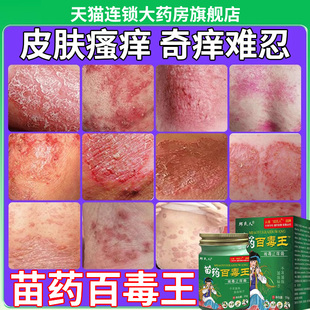 苗药百毒王拔毒膏抑菌膏药房膏旗舰店正品全身皮肤护理草本乳膏er
