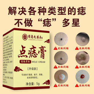 点痣膏无痕点斑脸部专用去痣水除去黑痣祛膏取药房旗舰店正品2tl