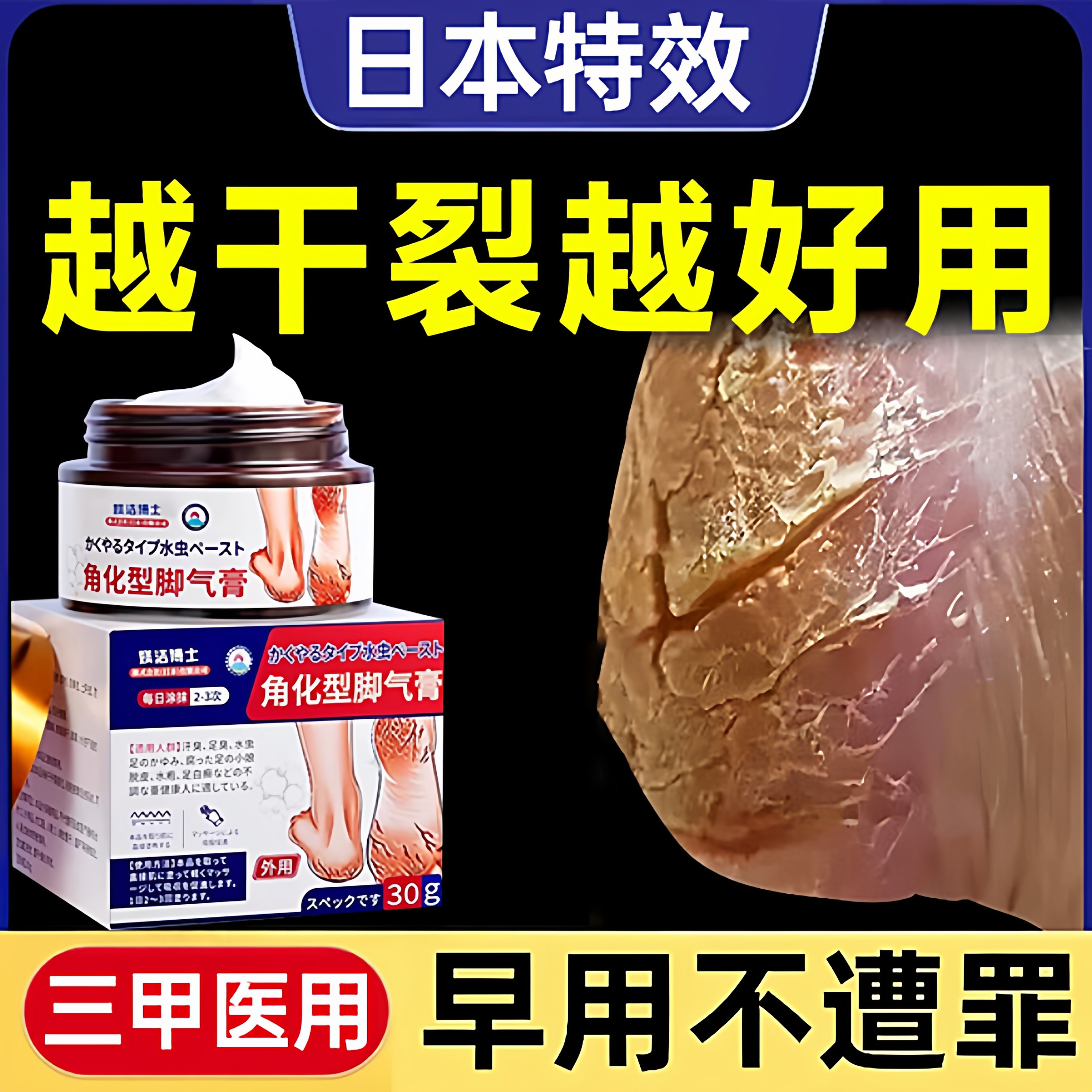 去角化型脚气开裂裂口脱皮专杀菌真菌感染用止根痒药脚后跟干裂ep