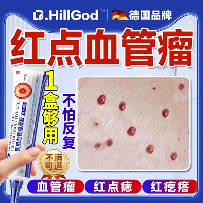 血管瘤血管痣去除樱桃状血管瘤
