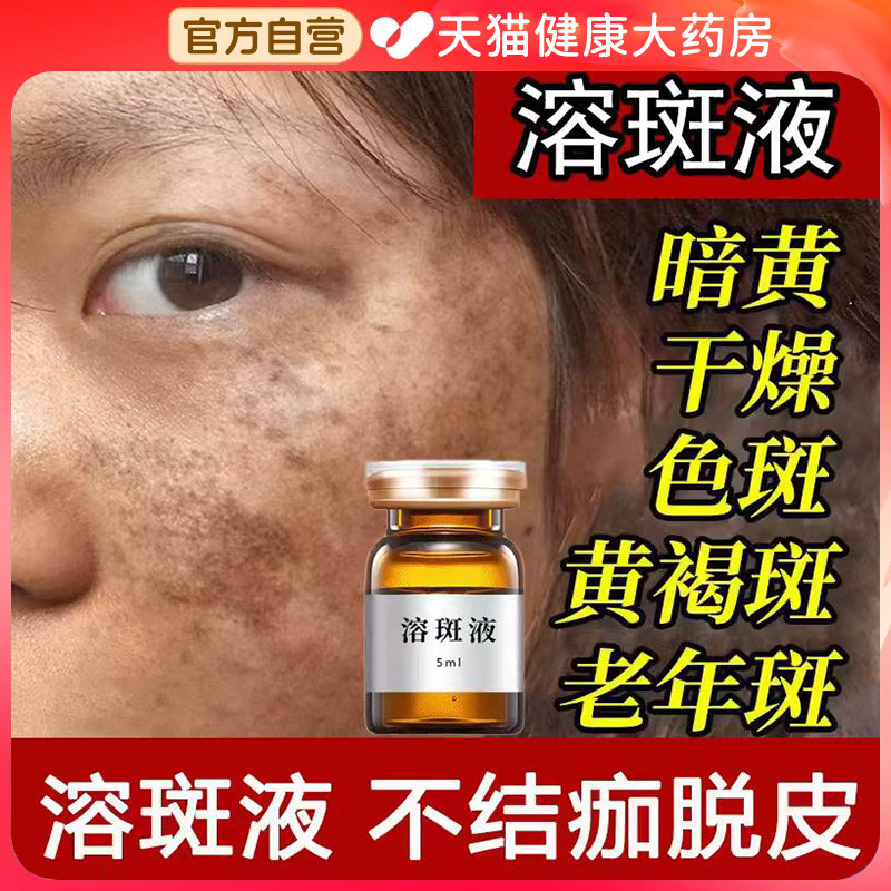 点斑药水不留疤脸部专用点斑液点痣药膏无痕美白正品官方旗舰店gh