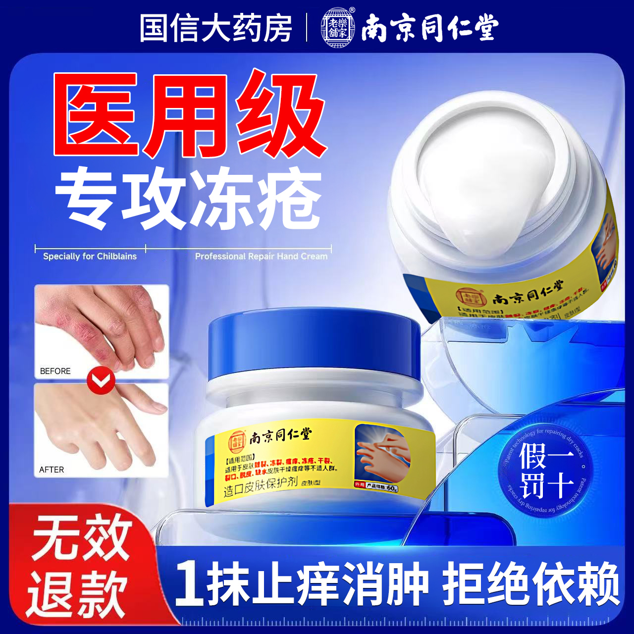 医用冻疮膏止痒冻伤膏正品特效防儿童冻裂耳朵消肿修复护手足霜nx