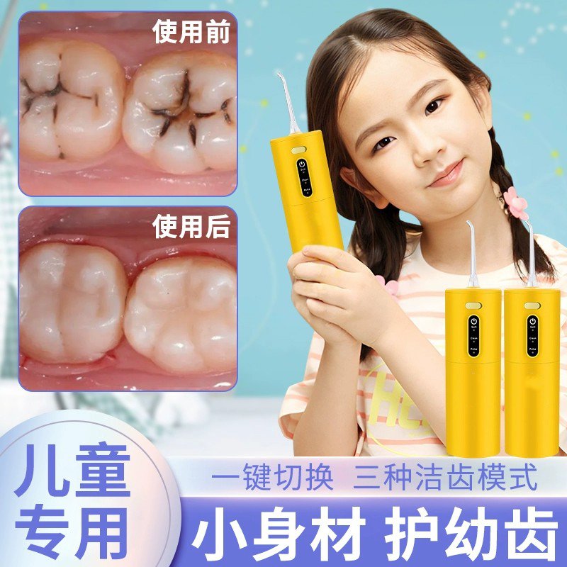 便携冲牙器儿童专用牙齿深层清洁