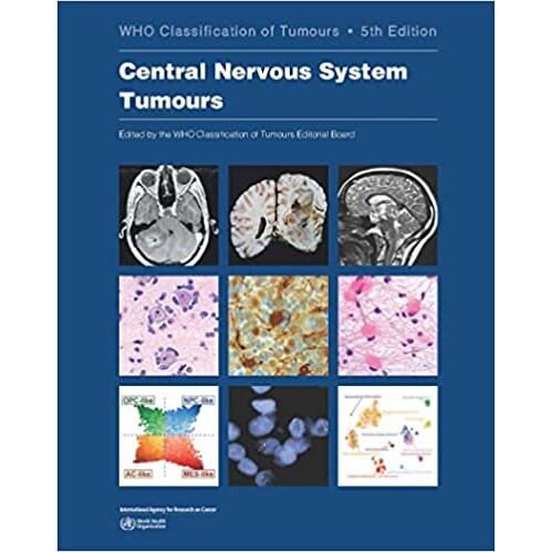 Central Nervous System Tumours *神经系统肿瘤 9789283245087