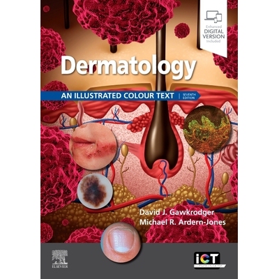 Dermatology An Illustrated Colour Text 皮肤病学：插图彩色文本 9780702079962
