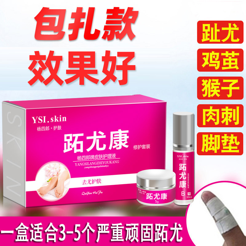 杨四郎跖尤康趾尤净手足尤去足部鸡眼膏贴肉刺猴子血泡刺