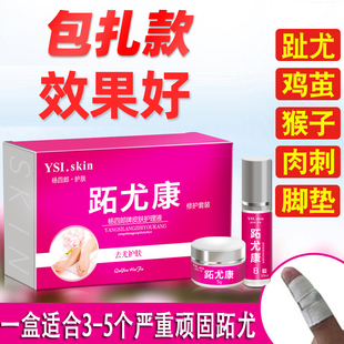 杨四郎跖尤康趾尤净手足尤去足部鸡眼膏贴肉刺猴子血泡刺