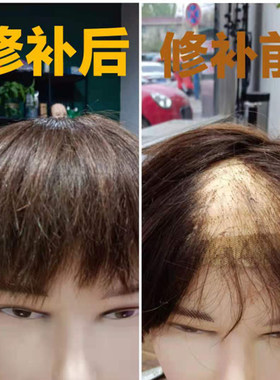 假发片男短发 全真人发 头顶补发片 修补染色修剪