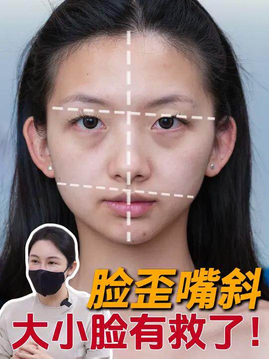 草本脸部歪斜修复精华 矫正归位改善面部偏够不规则加强版