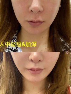 草本人中缩短加深精华 加强版