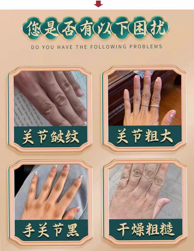 去手指关节皱纹祛除手粗糙干燥手背暗沉黑修复手纹护手保湿嫩肤液