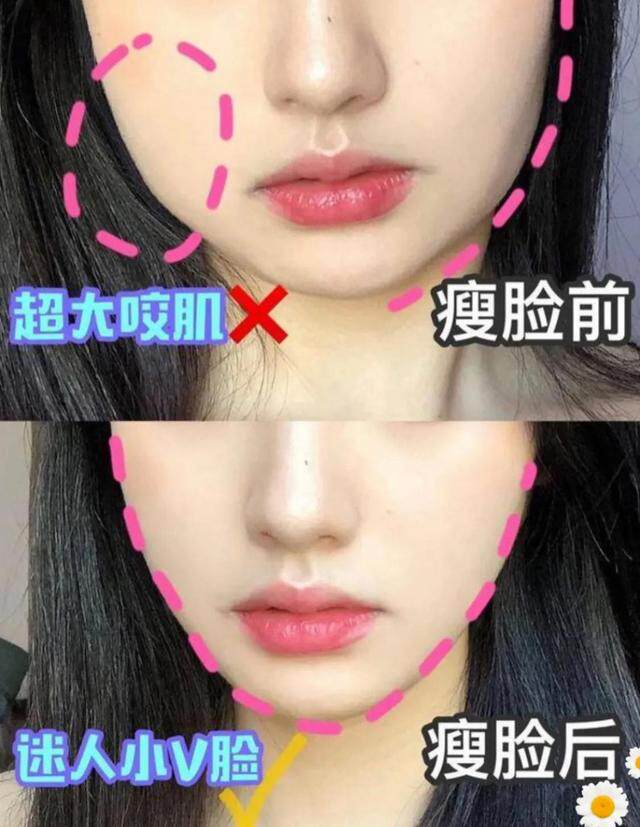 瘦全脸瘦额头廋鼻子瘦嘴唇瘦颧骨瘦下巴 一瓶多效 告别瓶瓶罐罐