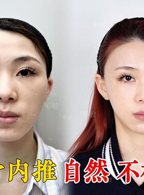 草本颧骨内推修复精华 内收改善脸骨突出精油加强版