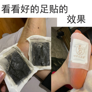 足贴 时珍太医堂李时珍艾草通用护理排毒去湿气睡眠正品通络药包
