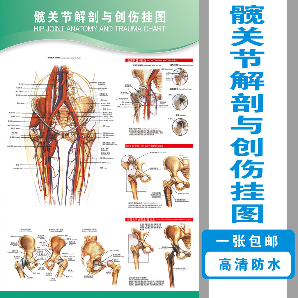 骨科宣传知识髋关节解剖与创伤示意图 肌肉示意图 医院解剖海报