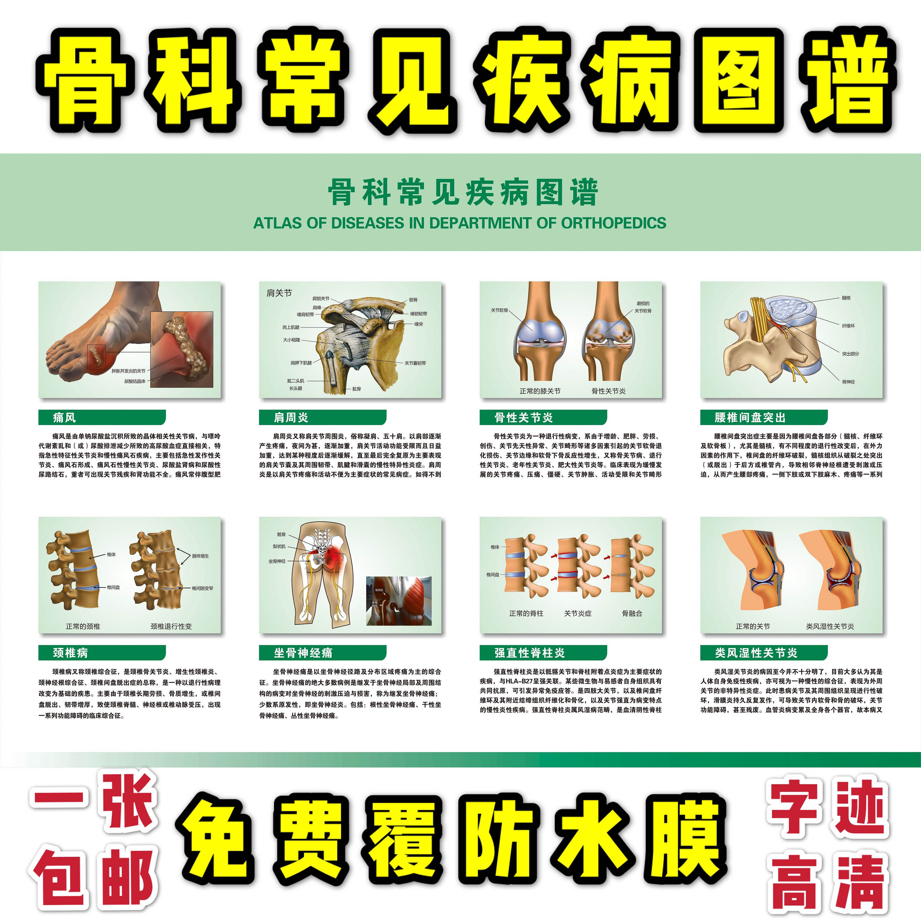 骨科常见疾病图谱 医学海报挂图 人体骨骼结构展板 写真 解剖海报