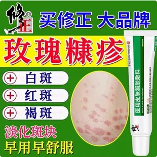玫瑰糠疹专用皮肤红斑诊过敏止痒膏花斑藓真菌感染儿童喷雾8