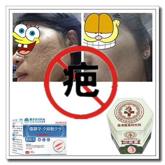 增生性凸疤烟烫冻疮疙瘩祛手术产后开伤疤痕印灵消除去缝针色素药