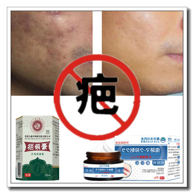 除去男女冻疮软化淡化增生性凸疙瘩祛手术后剖宫产伤疤痕印灵药膏