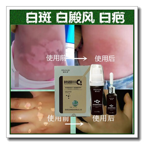 促黑色素白斑净白殿风遮盖白色白印药膏持久外用正品防水型遮瑕霜