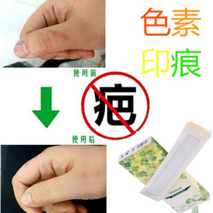 疤痕印正品去除黑色素沉淀去手术伤痕疙瘩淡化色素印沉着修复膏霜