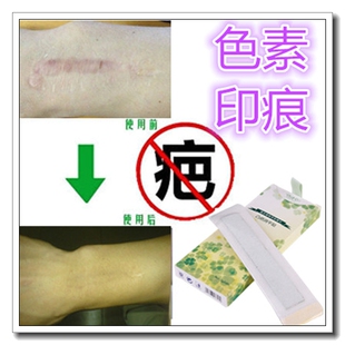 去烧除伤疤巴痕增生的药祛黑素脸部黑色素遮盖增生疤痕凸起疙瘩贴