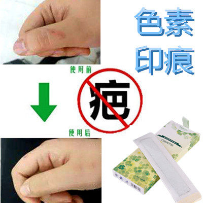 草本去除黑色素沉着修复膏淡化黑印祛男女士色素印痕疤痕印伤疤贴