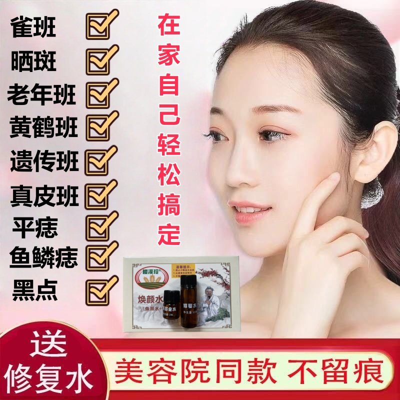 【不留痕】古方植物萃取美容金水点斑去班点痣祛痣药水修复液套装