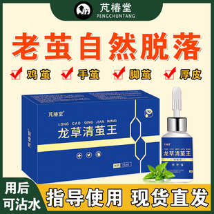 芃椿堂正品去小脚趾鸡茧脚底老茧神器手掌厚茧脚垫硬皮去除软化剂