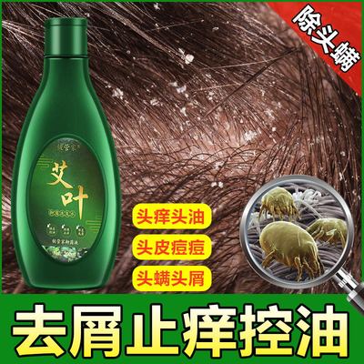 去屑止痒控油防脱男女通用毛囊