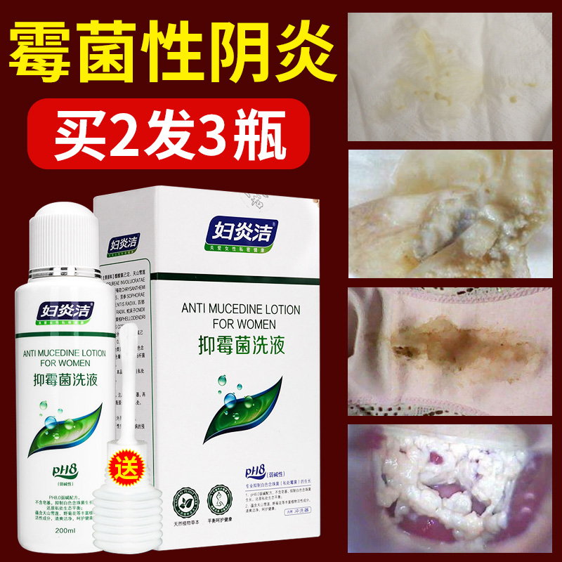 妇炎洁女性私处护理液霉菌性阴炎阴道冲洗液私密杀菌止痒妇科洗液