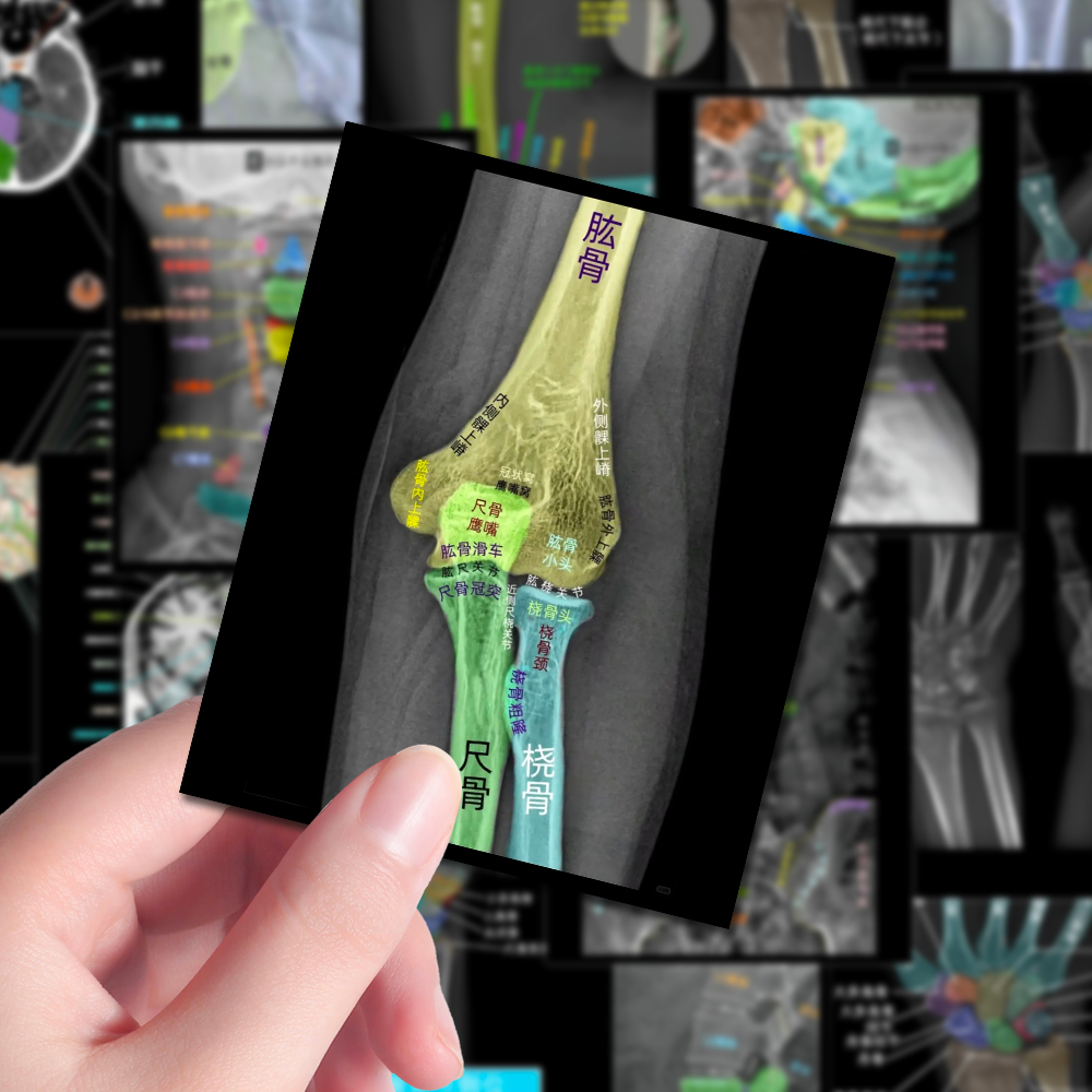 72张影像学习笔记贴纸医学生CT图解知识执业考试干货装饰手账贴画