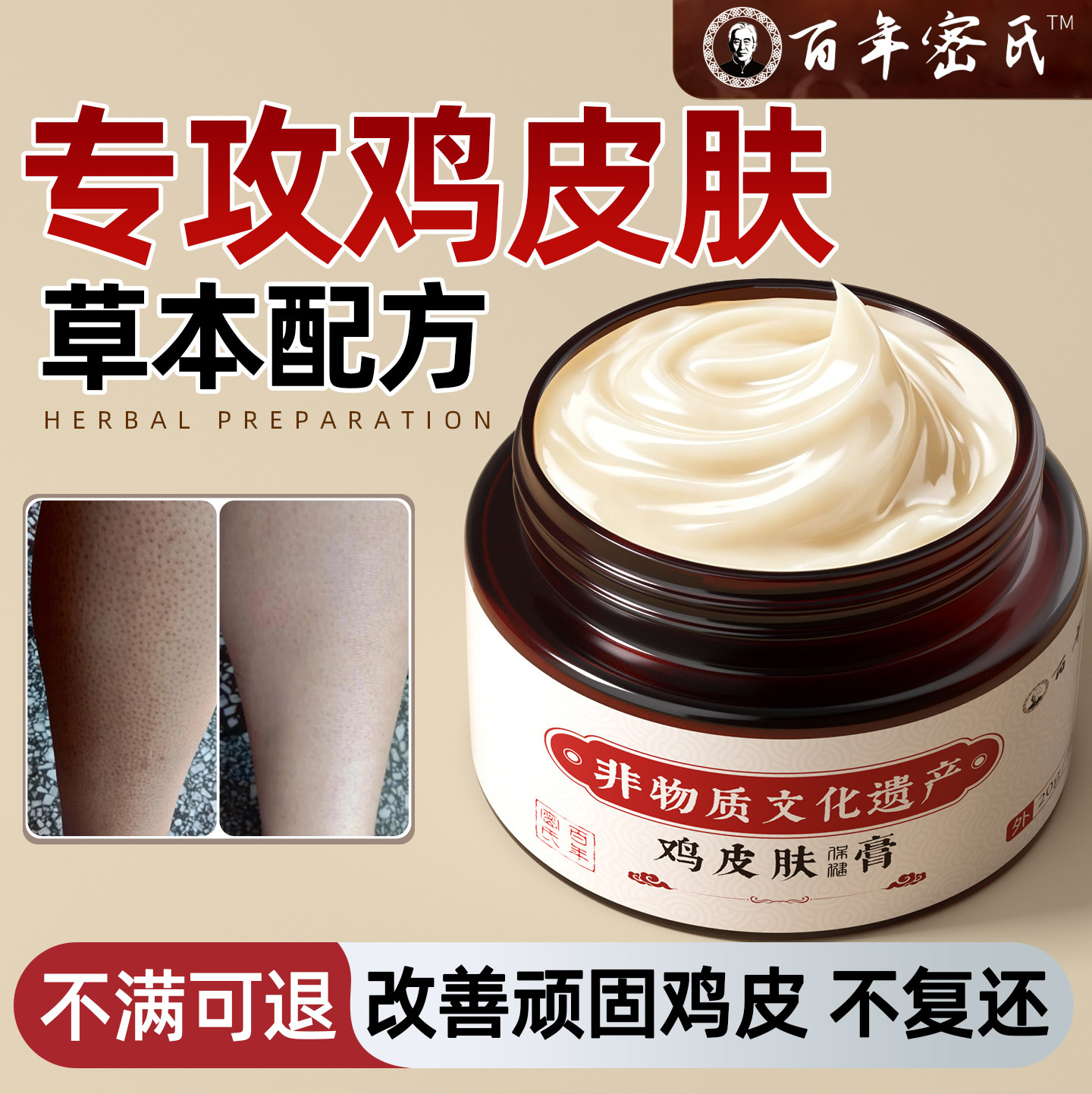 改善鸡皮肤乳去除全身体瘩毛囊角化疙专用膏神器症手臂腿胳膊非药